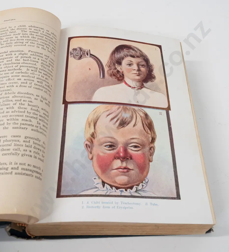 vintage book: Household Medical Adviser - H. Mueller MD with colour plates - wear, damage to binding and to cut-out Image 1++